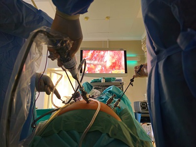 Эндоскопические стойки